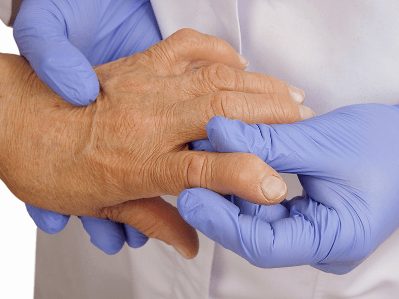 El médico examina la mano para detectar dolor en las articulaciones de los dedos.